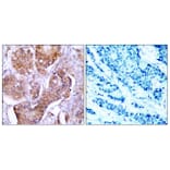 Immunohistochemistry - Anti-Estrogen Receptor-alpha (phospho Ser106) Antibody (A7076) - Antibodies.com