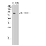 Western Blot - Anti-Estrogen Receptor-alpha (phospho Ser106) Antibody (A7076) - Antibodies.com