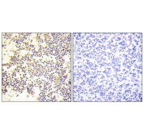 Immunohistochemistry - Anti-Neutrophil Cytosol Factor 1 (phospho Ser328) Antibody (A1161) - Antibodies.com