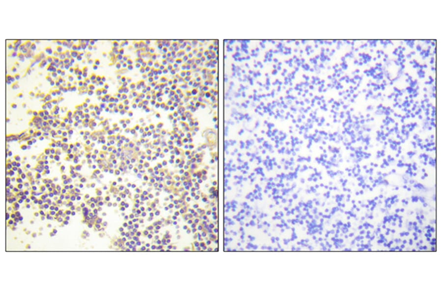 Immunohistochemistry - Anti-Neutrophil Cytosol Factor 1 (phospho Ser328) Antibody (A1161) - Antibodies.com