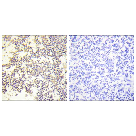 Immunohistochemistry - Anti-Neutrophil Cytosol Factor 1 (phospho Ser328) Antibody (A1161) - Antibodies.com