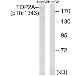 Western Blot - Anti-TOP2A (phospho Thr1343) Antibody (A8221) - Antibodies.com