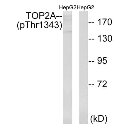 Western Blot - Anti-TOP2A (phospho Thr1343) Antibody (A8221) - Antibodies.com