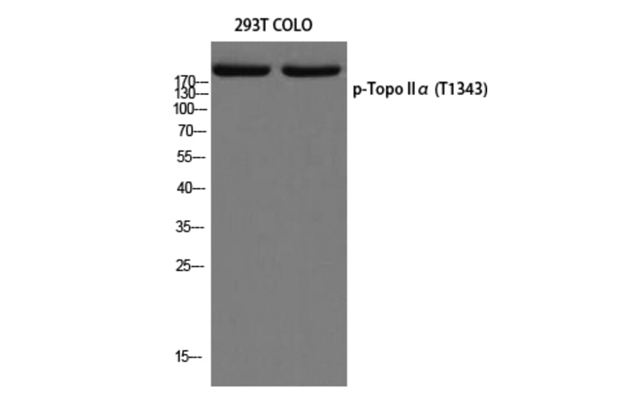 Western Blot - Anti-TOP2A (phospho Thr1343) Antibody (A8221) - Antibodies.com