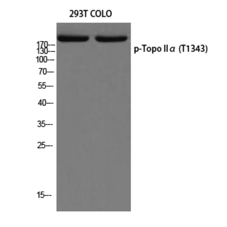 Western Blot - Anti-TOP2A (phospho Thr1343) Antibody (A8221) - Antibodies.com