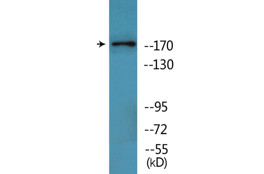 Western Blot - Anti-TOP2A (phospho Thr1343) Antibody (P12-1192) - Antibodies.com