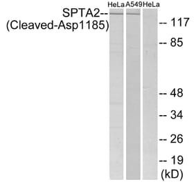 Western Blot - Anti-SPTA2 (cleaved Asp1185) Antibody (L0134) - Antibodies.com