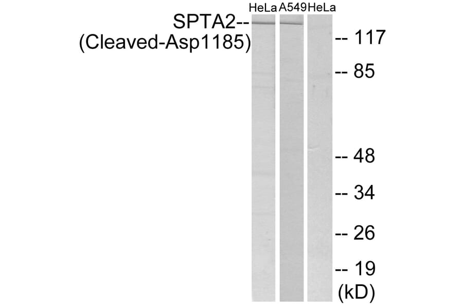 Western Blot - Anti-SPTA2 (cleaved Asp1185) Antibody (L0134) - Antibodies.com