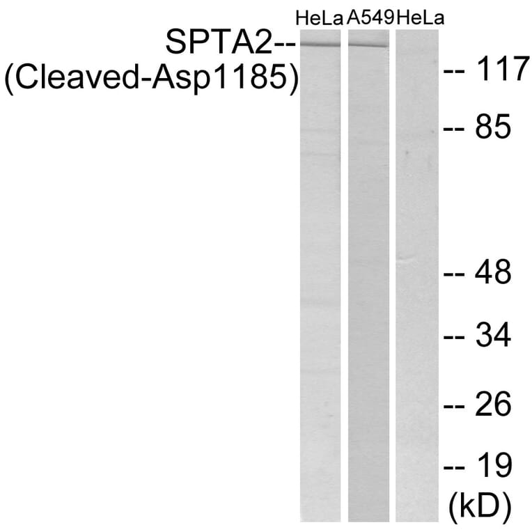 Western Blot - Anti-SPTA2 (cleaved Asp1185) Antibody (L0134) - Antibodies.com