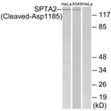 Western Blot - Anti-SPTA2 (cleaved Asp1185) Antibody (L0134) - Antibodies.com