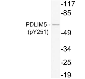 Western Blot - Anti-PDLIM5 (phospho Tyr251) Antibody (P12-1042) - Antibodies.com