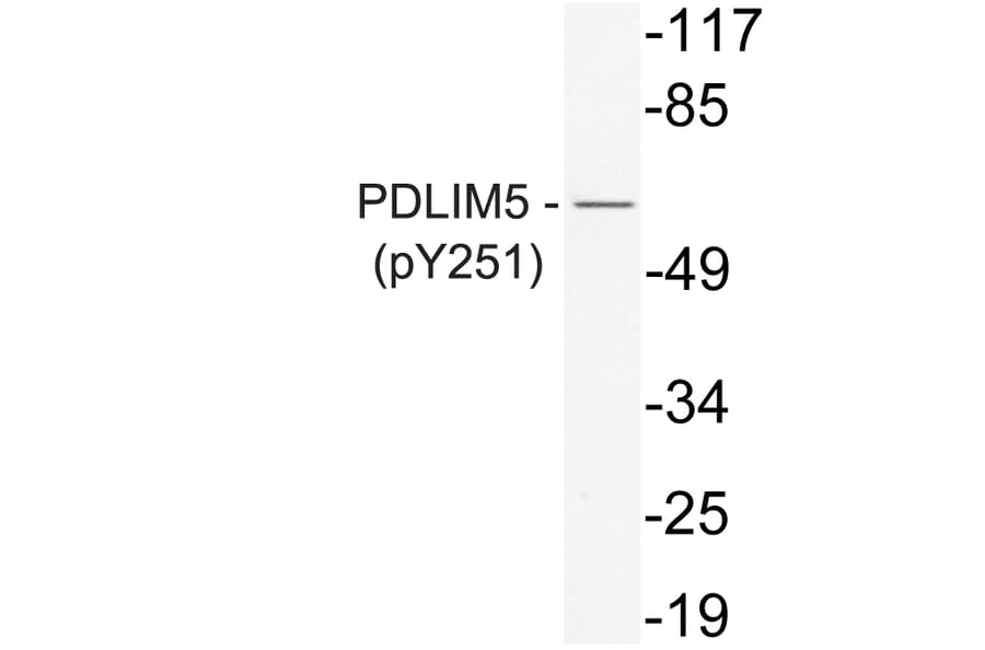 Western Blot - Anti-PDLIM5 (phospho Tyr251) Antibody (P12-1042) - Antibodies.com