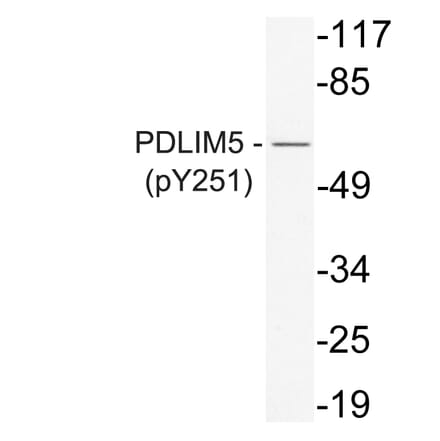 Western Blot - Anti-PDLIM5 (phospho Tyr251) Antibody (P12-1042) - Antibodies.com