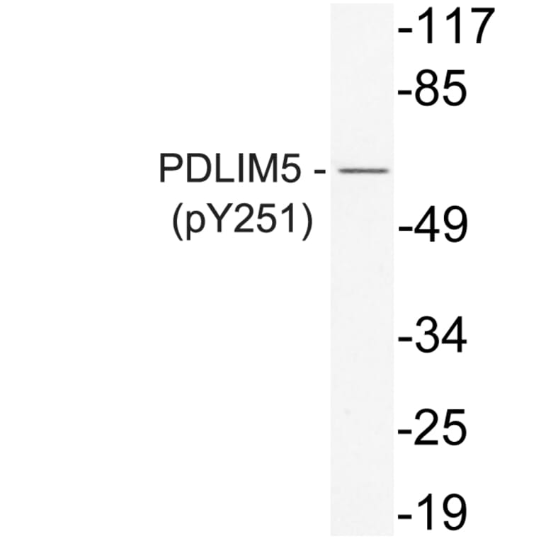 Western Blot - Anti-PDLIM5 (phospho Tyr251) Antibody (P12-1042) - Antibodies.com
