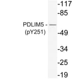 Western Blot - Anti-PDLIM5 (phospho Tyr251) Antibody (P12-1042) - Antibodies.com
