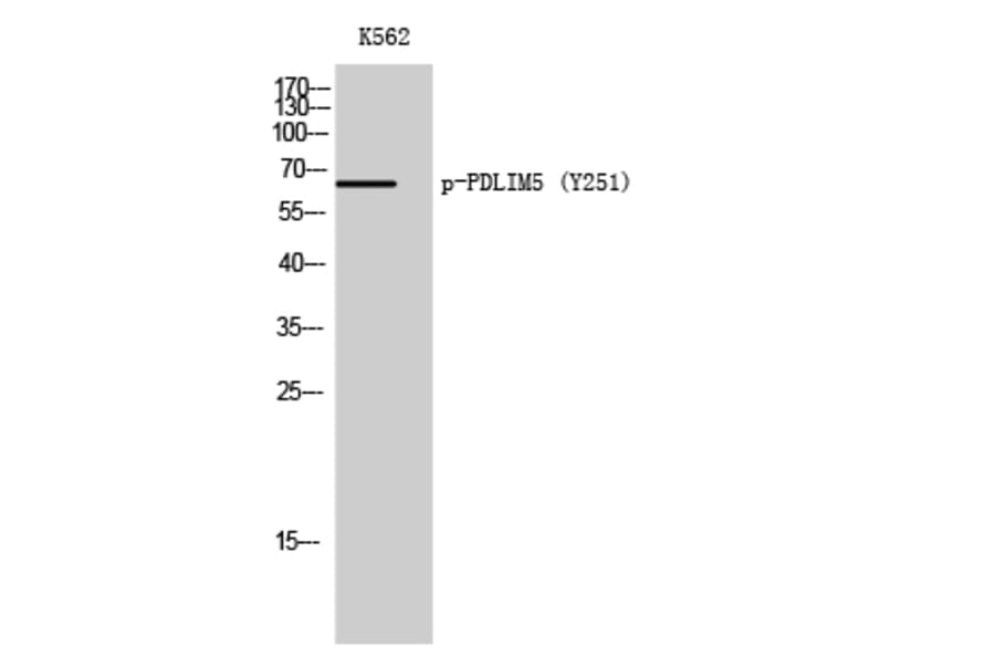 Western Blot - Anti-PDLIM5 (phospho Tyr251) Antibody (P12-1042) - Antibodies.com