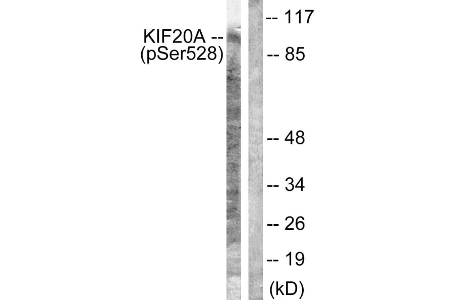 Western Blot - Anti-KIF20A (phospho Ser528) Antibody (A1082) - Antibodies.com