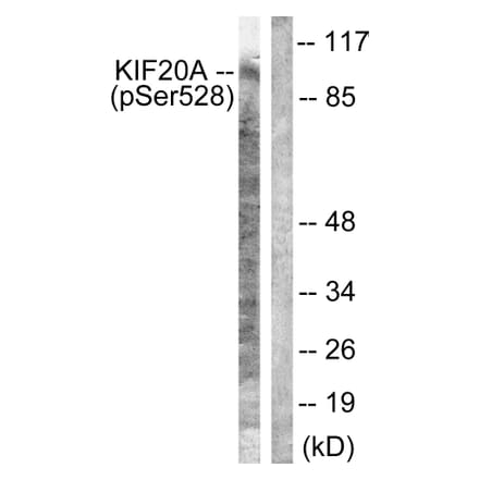 Western Blot - Anti-KIF20A (phospho Ser528) Antibody (A1082) - Antibodies.com
