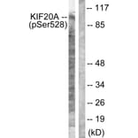 Western Blot - Anti-KIF20A (phospho Ser528) Antibody (A1082) - Antibodies.com