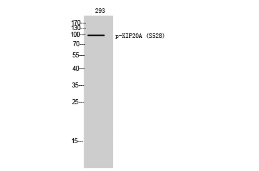 Western Blot - Anti-KIF20A (phospho Ser528) Antibody (A1082) - Antibodies.com