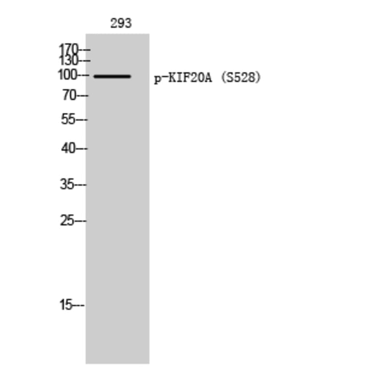 Western Blot - Anti-KIF20A (phospho Ser528) Antibody (A1082) - Antibodies.com