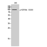 Western Blot - Anti-KIF20A (phospho Ser528) Antibody (A1082) - Antibodies.com