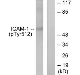 Western Blot - Anti-ICAM-1 (phospho Tyr512) Antibody (A7113) - Antibodies.com