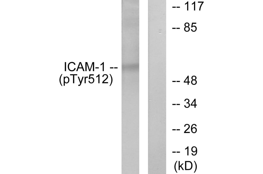 Western Blot - Anti-ICAM-1 (phospho Tyr512) Antibody (A7113) - Antibodies.com