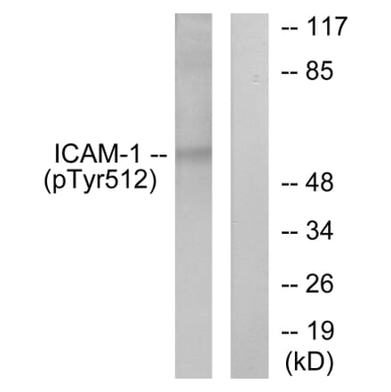 Western Blot - Anti-ICAM-1 (phospho Tyr512) Antibody (A7113) - Antibodies.com
