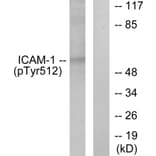 Western Blot - Anti-ICAM-1 (phospho Tyr512) Antibody (A7113) - Antibodies.com