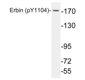 Western Blot - Anti-Erbin (phospho Tyr1104) Antibody (P12-1021) - Antibodies.com