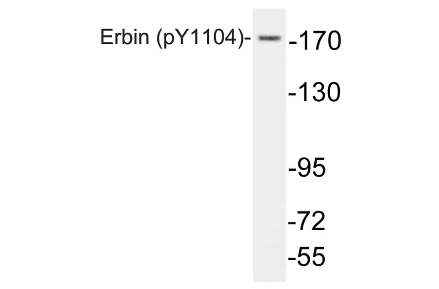 Western Blot - Anti-Erbin (phospho Tyr1104) Antibody (P12-1021) - Antibodies.com