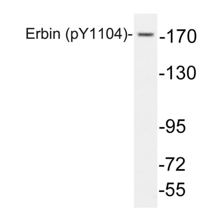 Western Blot - Anti-Erbin (phospho Tyr1104) Antibody (P12-1021) - Antibodies.com