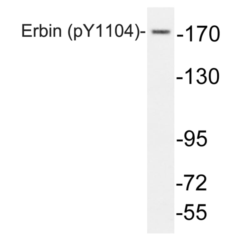Western Blot - Anti-Erbin (phospho Tyr1104) Antibody (P12-1021) - Antibodies.com