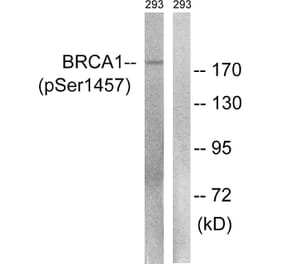 Western Blot - Anti-BRCA1 (phospho Ser1457) Antibody (A8306) - Antibodies.com