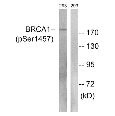 Western Blot - Anti-BRCA1 (phospho Ser1457) Antibody (A8306) - Antibodies.com