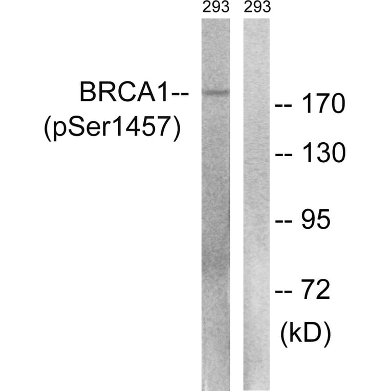 Western Blot - Anti-BRCA1 (phospho Ser1457) Antibody (A8306) - Antibodies.com
