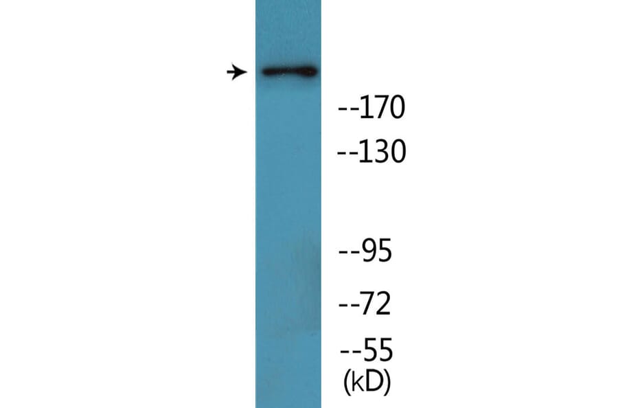 Western Blot - Anti-BRCA1 (phospho Ser1457) Antibody (P12-1082) - Antibodies.com