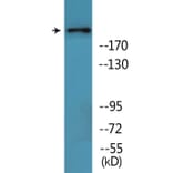 Western Blot - Anti-BRCA1 (phospho Ser1457) Antibody (P12-1082) - Antibodies.com
