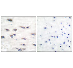 Immunohistochemistry - Anti-Trk A (phospho Tyr791) Antibody (A0034) - Antibodies.com