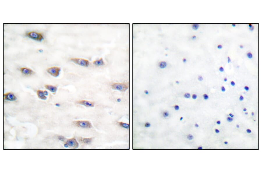 Immunohistochemistry - Anti-Trk A (phospho Tyr791) Antibody (A0034) - Antibodies.com
