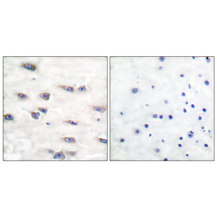 Immunohistochemistry - Anti-Trk A (phospho Tyr791) Antibody (A0034) - Antibodies.com
