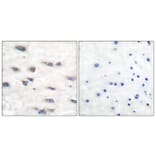 Immunohistochemistry - Anti-Trk A (phospho Tyr791) Antibody (A0034) - Antibodies.com