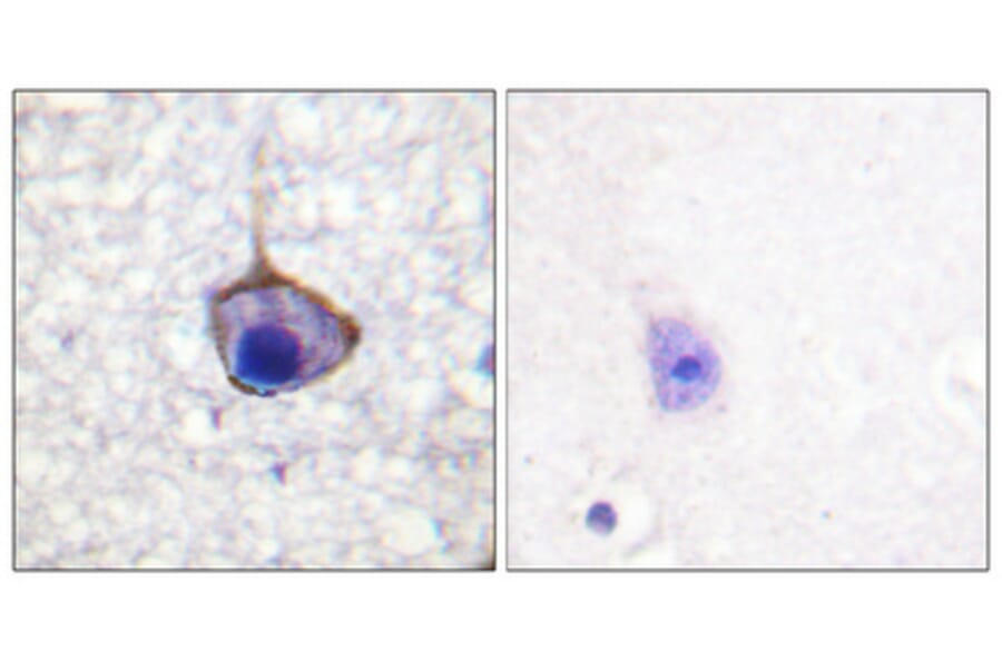 Immunohistochemistry - Anti-Trk A (phospho Tyr791) Antibody (A0034) - Antibodies.com