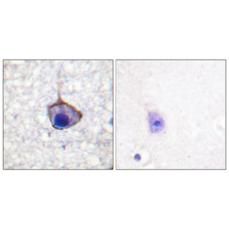 Immunohistochemistry - Anti-Trk A (phospho Tyr791) Antibody (A0034) - Antibodies.com