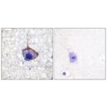 Immunohistochemistry - Anti-Trk A (phospho Tyr791) Antibody (A0034) - Antibodies.com