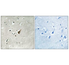 Immunohistochemistry - Anti-MUC1 (phospho Ser1227) Antibody (A8377) - Antibodies.com