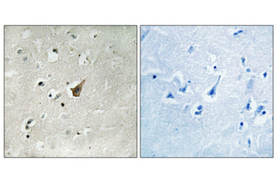 Immunohistochemistry - Anti-MUC1 (phospho Ser1227) Antibody (A8377) - Antibodies.com