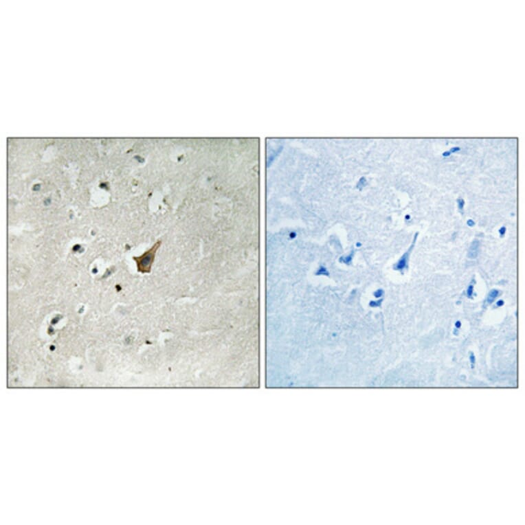 Immunohistochemistry - Anti-MUC1 (phospho Ser1227) Antibody (A8377) - Antibodies.com