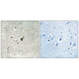 Immunohistochemistry - Anti-MUC1 (phospho Ser1227) Antibody (A8377) - Antibodies.com